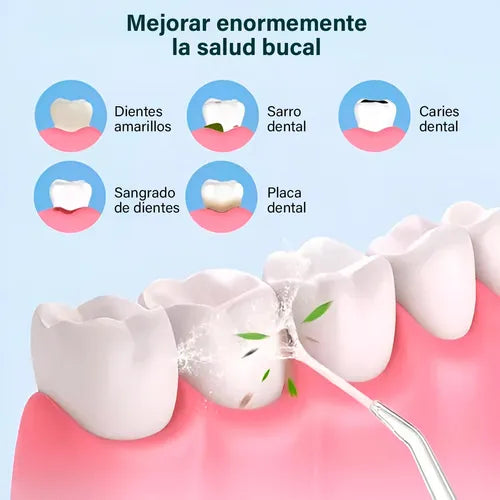 IRRIGADOR BUCAL